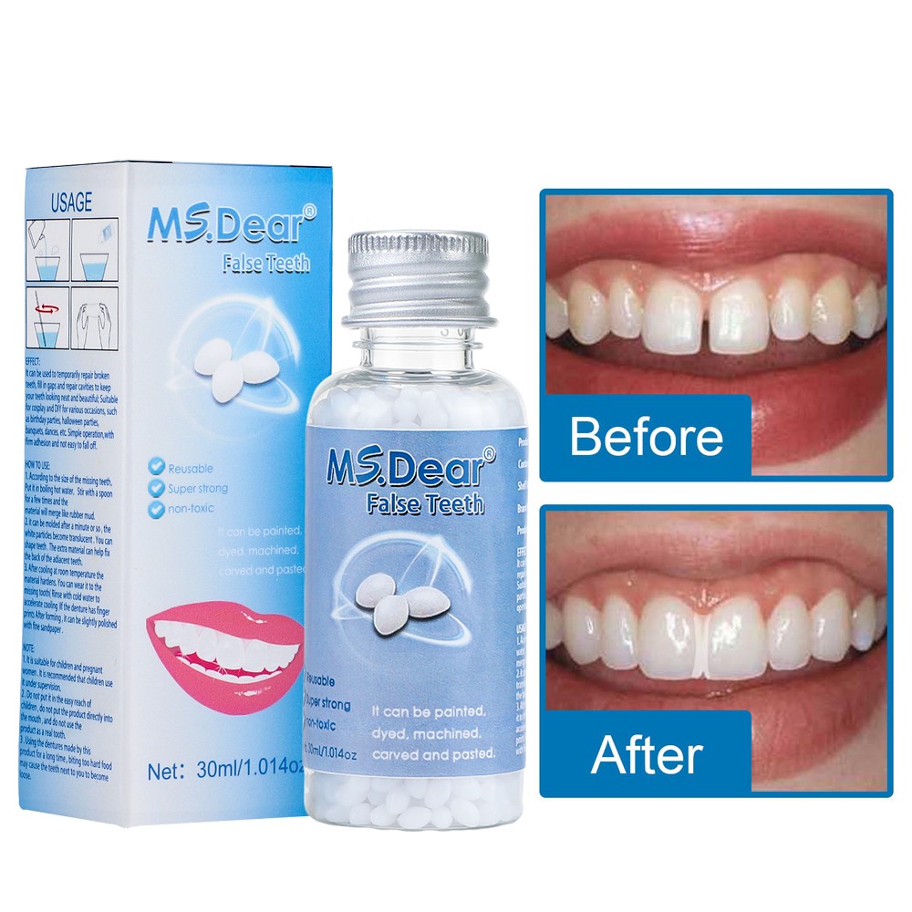 Moldable Teeth Beads Repair Kit - Temporary Fix for Missing, Broken or Gap Teeth