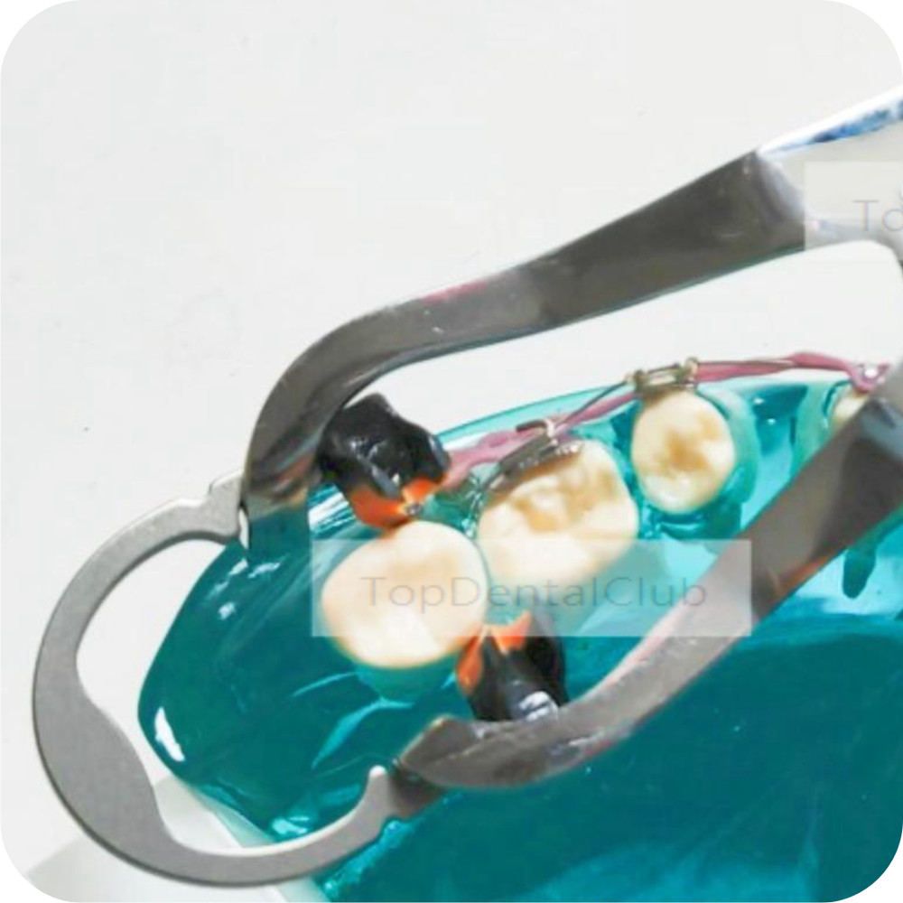 Dental Seperator Plier Sectional Matrix System Fits Premier Matrices Ring Clamp