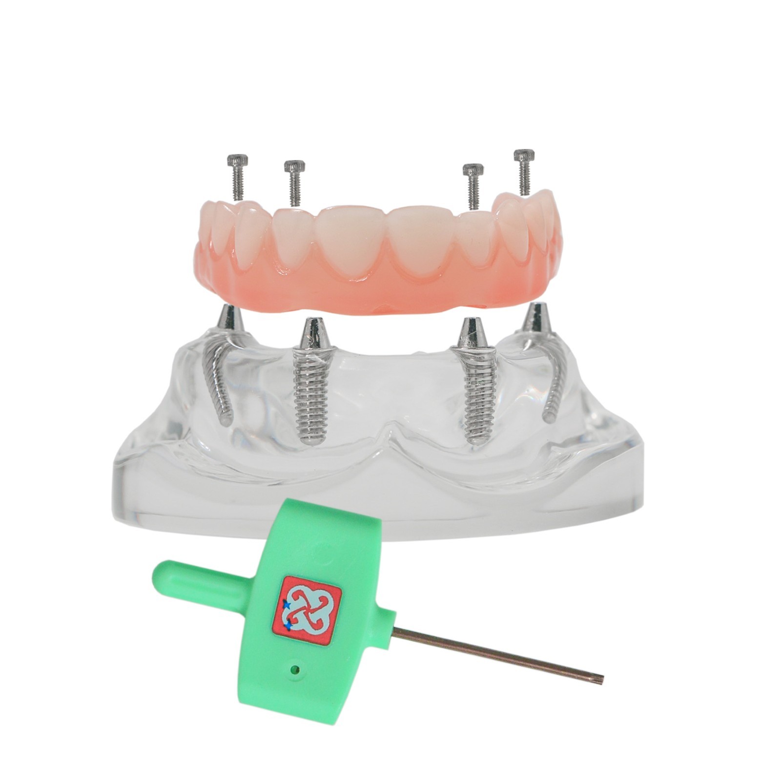 Implant Overdenture Al-on-4 treatment concept Demo Teeth Model Upper/4Srew Clear