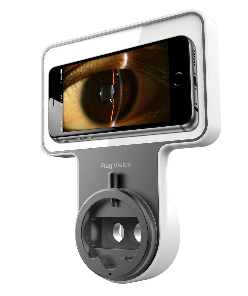 Phonto Imaging Optic System Apple Slit lamp Adapter Android Smart Phone Adaptor