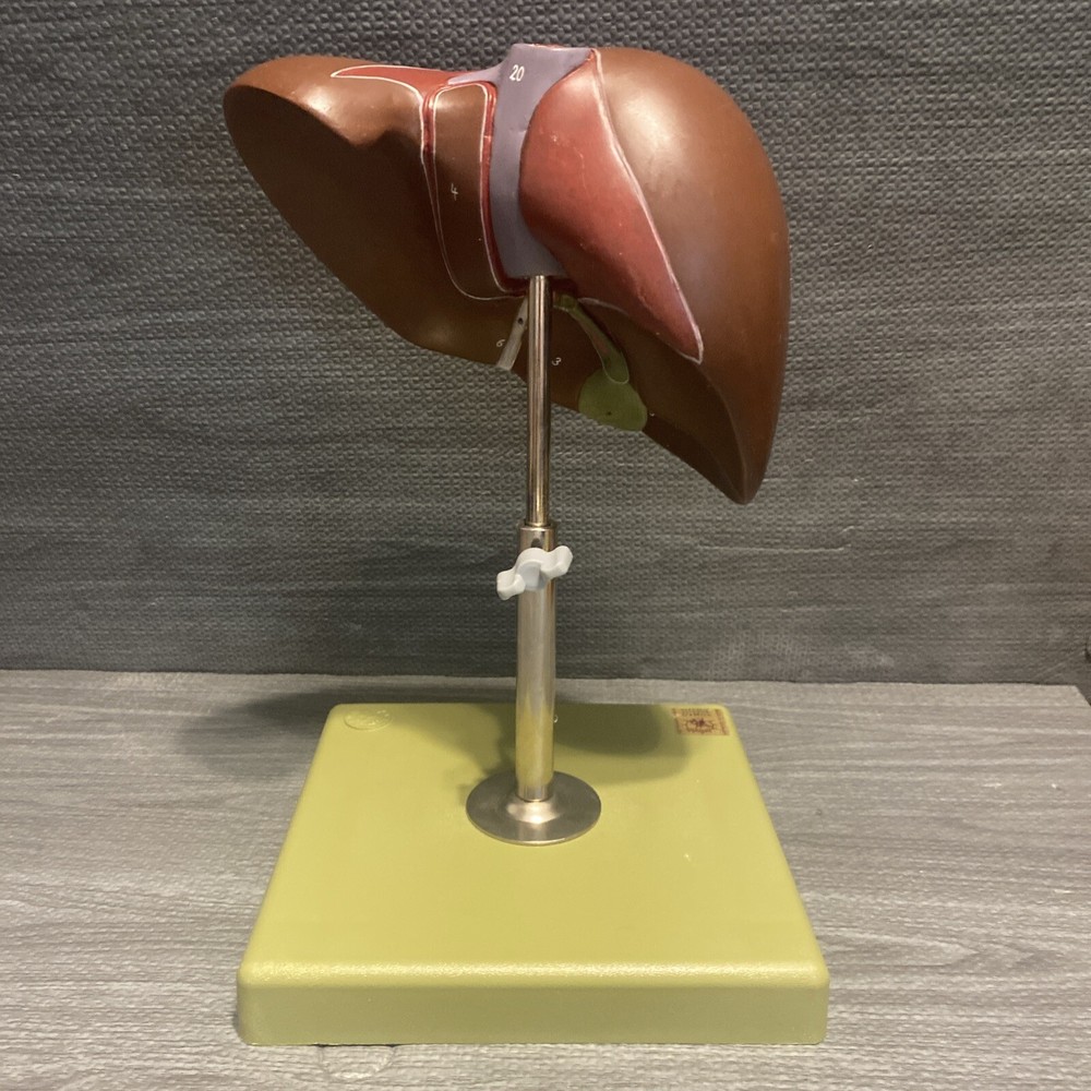 Somso Liver On Adjustable Stand Model - Numbered - Damaged