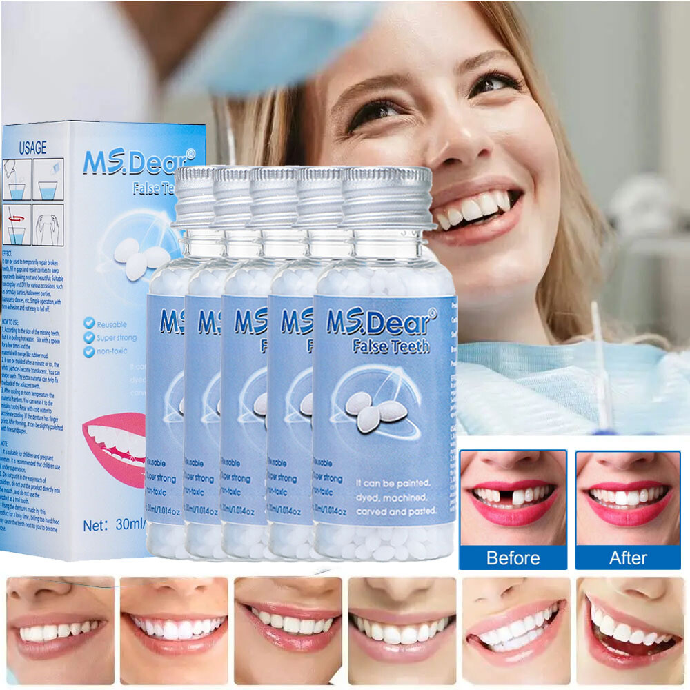 Resin False Teeth Solid Glue Temporary Tooth Repair Moldable Teeth Gap Denture
