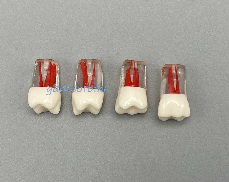 10x Dental Root Canal Teeth Study Practice Model Endodontic Pulp File Injection