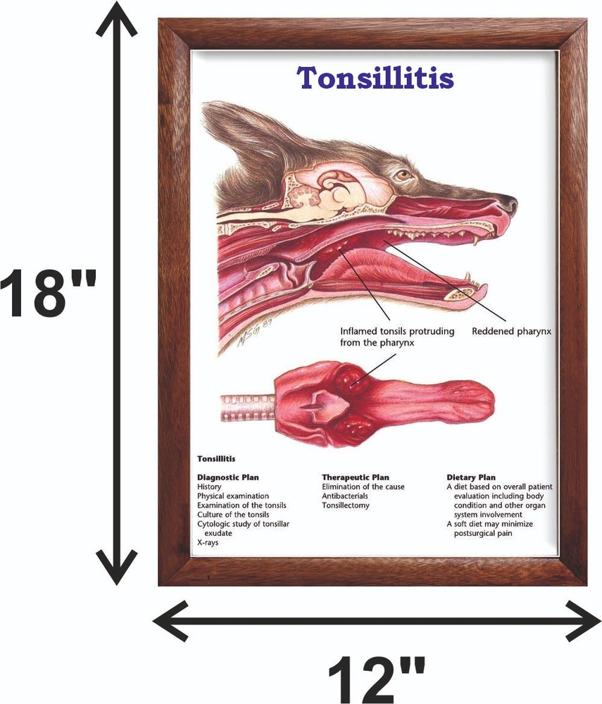 Tonsillitis Chart 12x18 inches