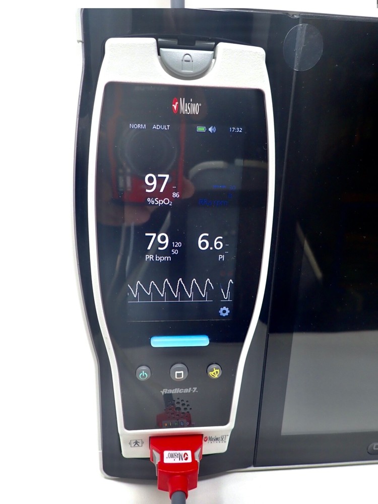Masimo RDA7A Sp02 - ROOT + Radical-7