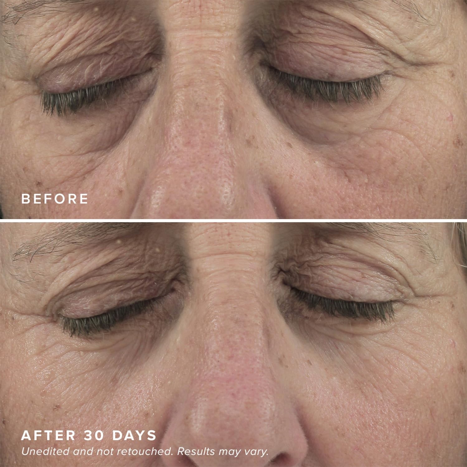 Brightening Eye Masks (30 Pairs) - Caffeine Eye Masks for Dark Circles and Pu