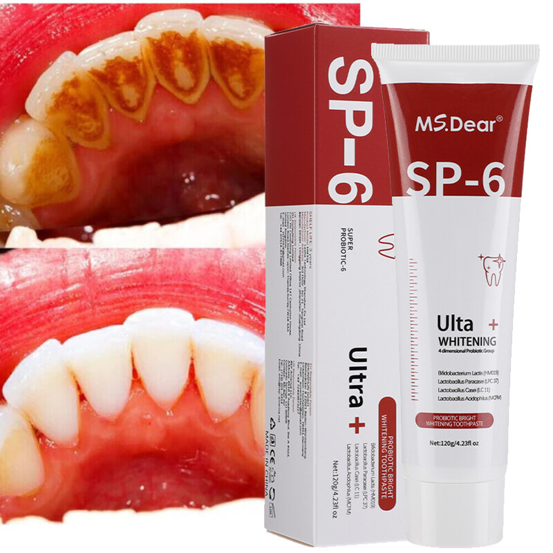 2PCS SP-6 Probiotic Toothpaste,Sp-6 Toothpaste Whitening Quick White Toothpaste