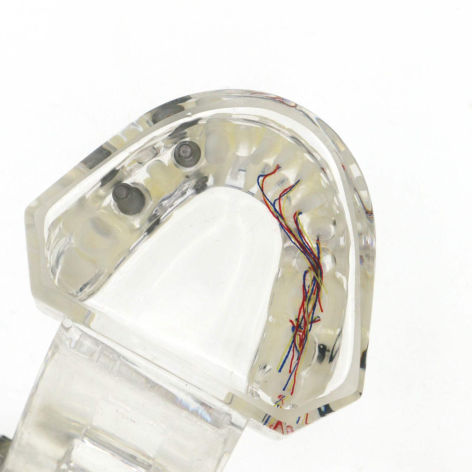 Dental Oral Typodont Model Implant Pathological Teaching Standard Size (Clear)