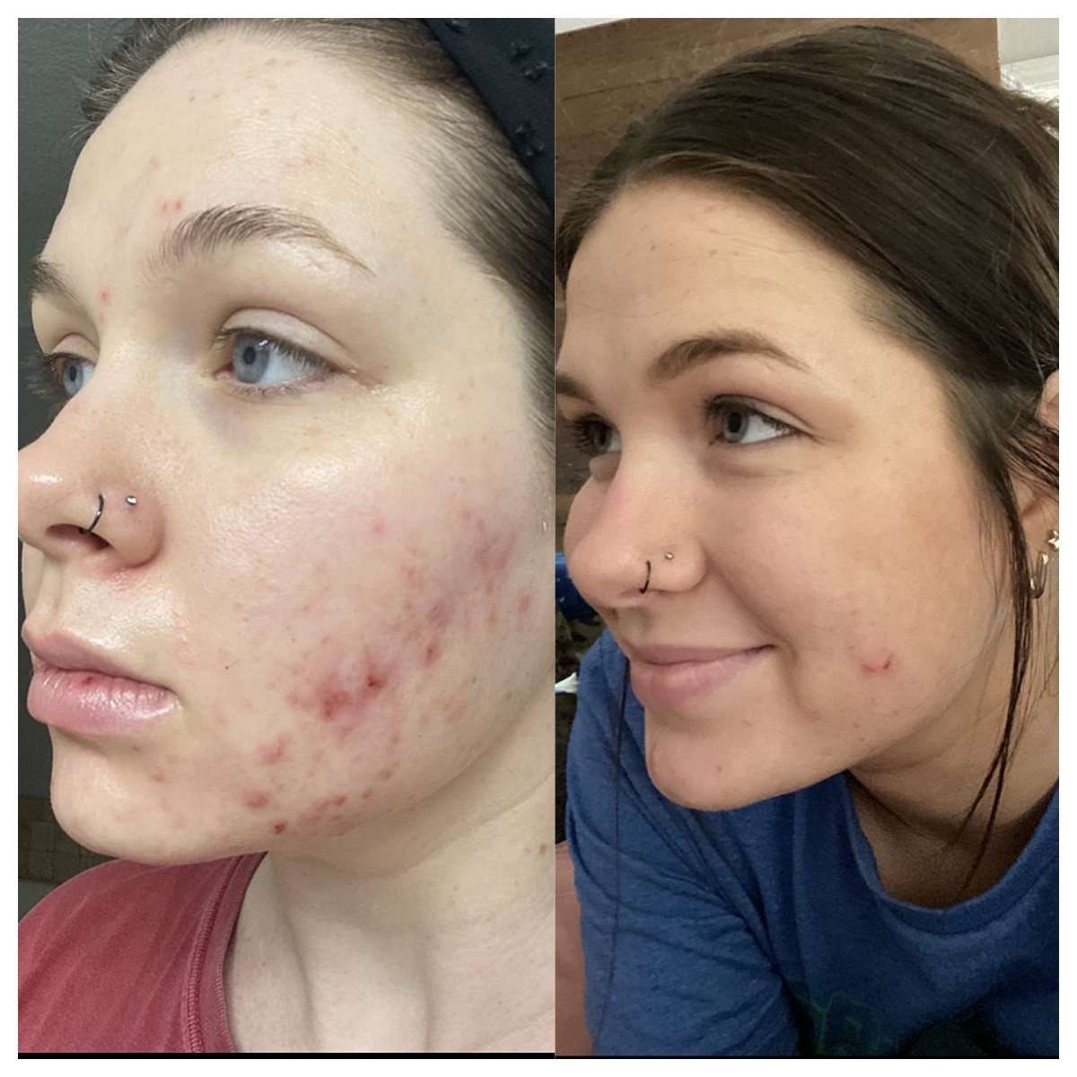 Liver Cleanse Detox & Repair Formula with Premium Milk Thistle - 45 Day Supply