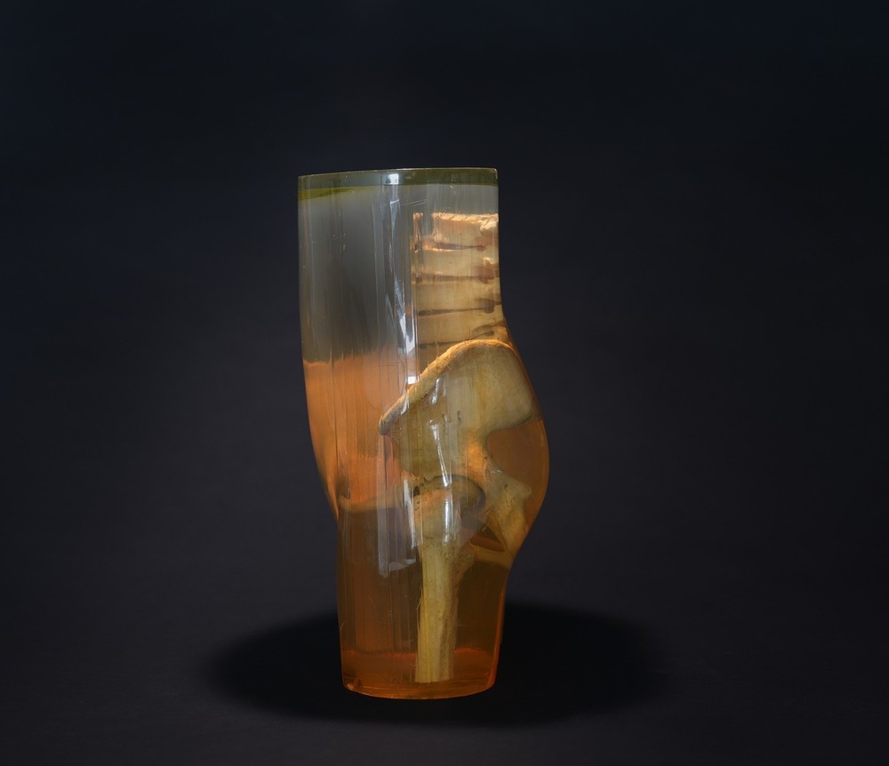 3M Xray Calibration Phantom Pelvis C.1960's