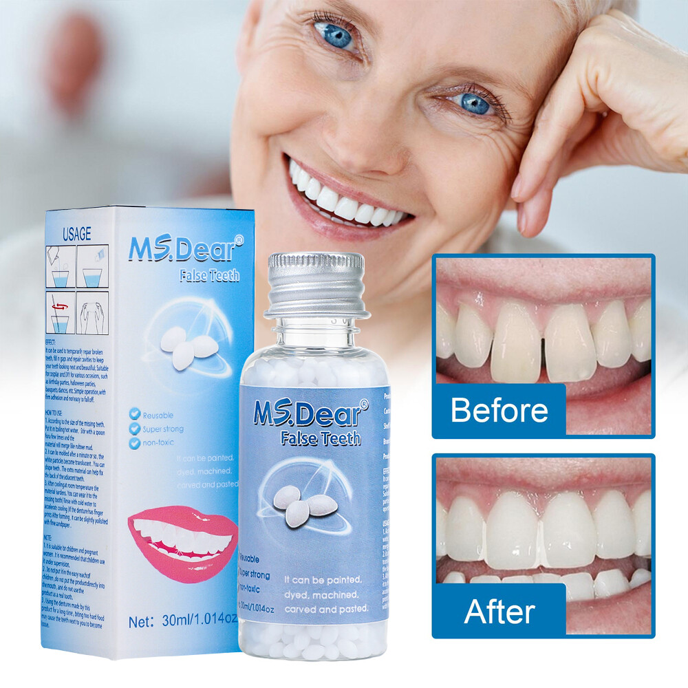 Tooth Repair Granules Temporary Kit Fitting Beads Reusable Moldable False Teeth