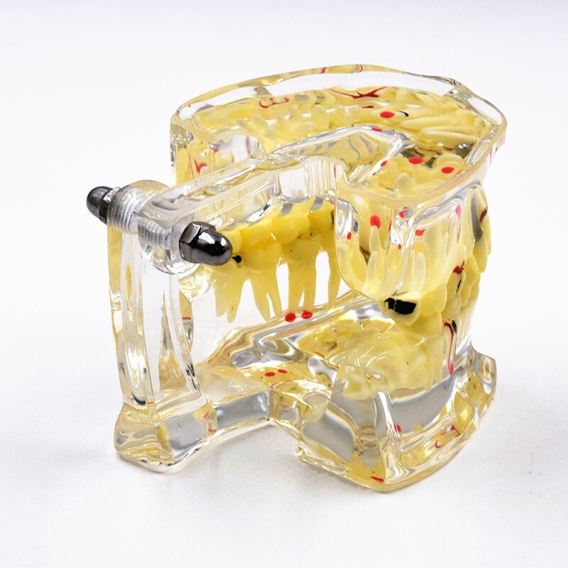 Dental Disease Teeth Model Pathological Transparent Adult Teaching Study 1 Pc