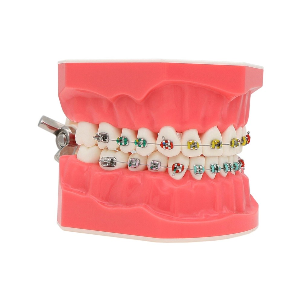 US Dental Typodont Teeth Model with Orthodontic Brackets Brushing