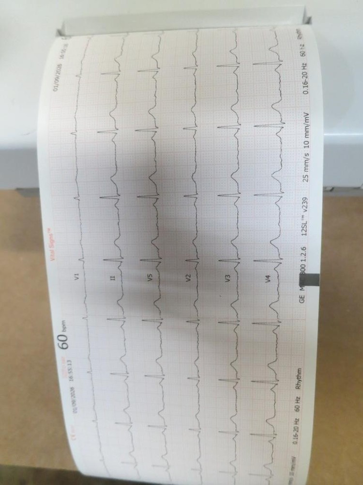 GE MARQUETTE MAC 800 EKG ECG INTERPRATIVE GUARANTEED