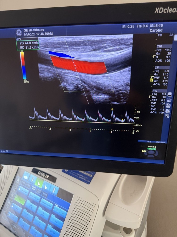 GE ML6-15 D Linear Vascular Probe , Excellent working condition,