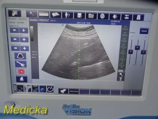 36099 |B@RD-Type SiteR¡te Vision Convex Probe | Ref 9770035 | Used, Tested