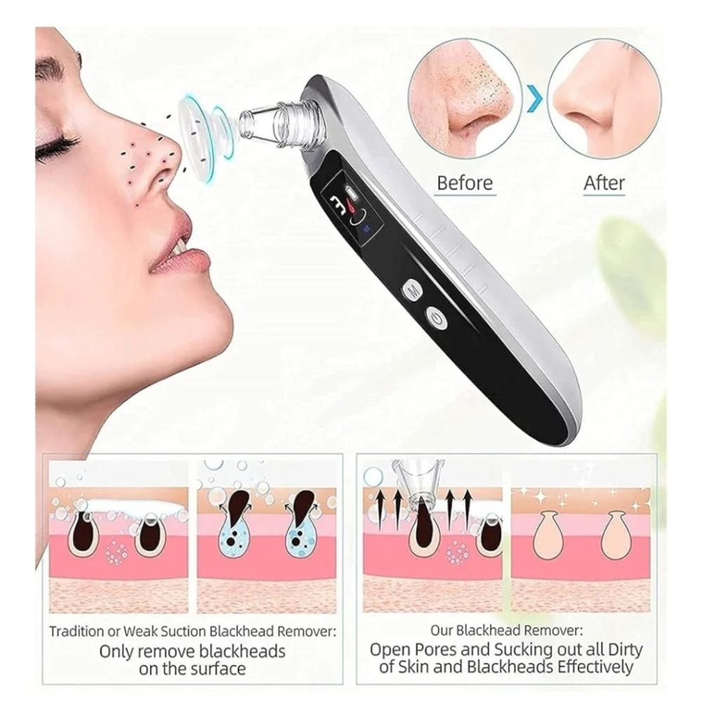 Advanced Blackhead Remover Vacuum - Black