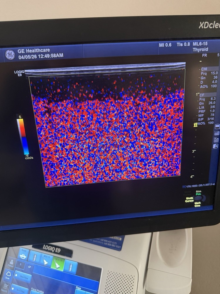 GE ML6-15 D Linear Vascular Probe , Excellent working condition,