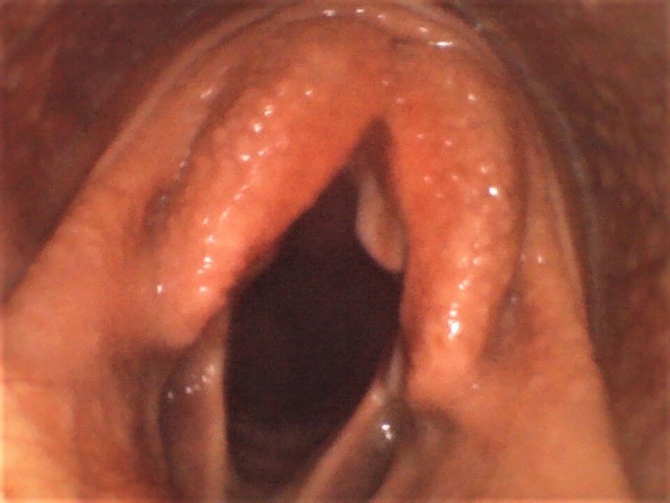 Vividia VE-8150 Portable Joystick Veterinary Horse Equine Upper Airway Endoscope