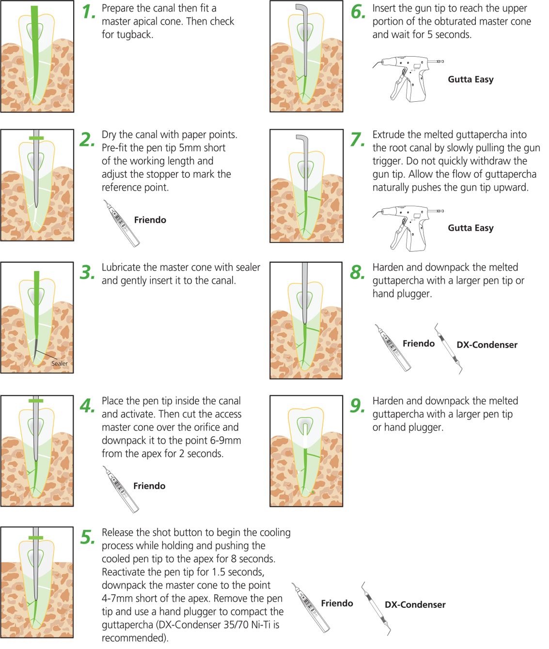 Obturation Gutta Easy Gun Tips 25G 6 Tips EndoApex System Endodontic [DXM]
