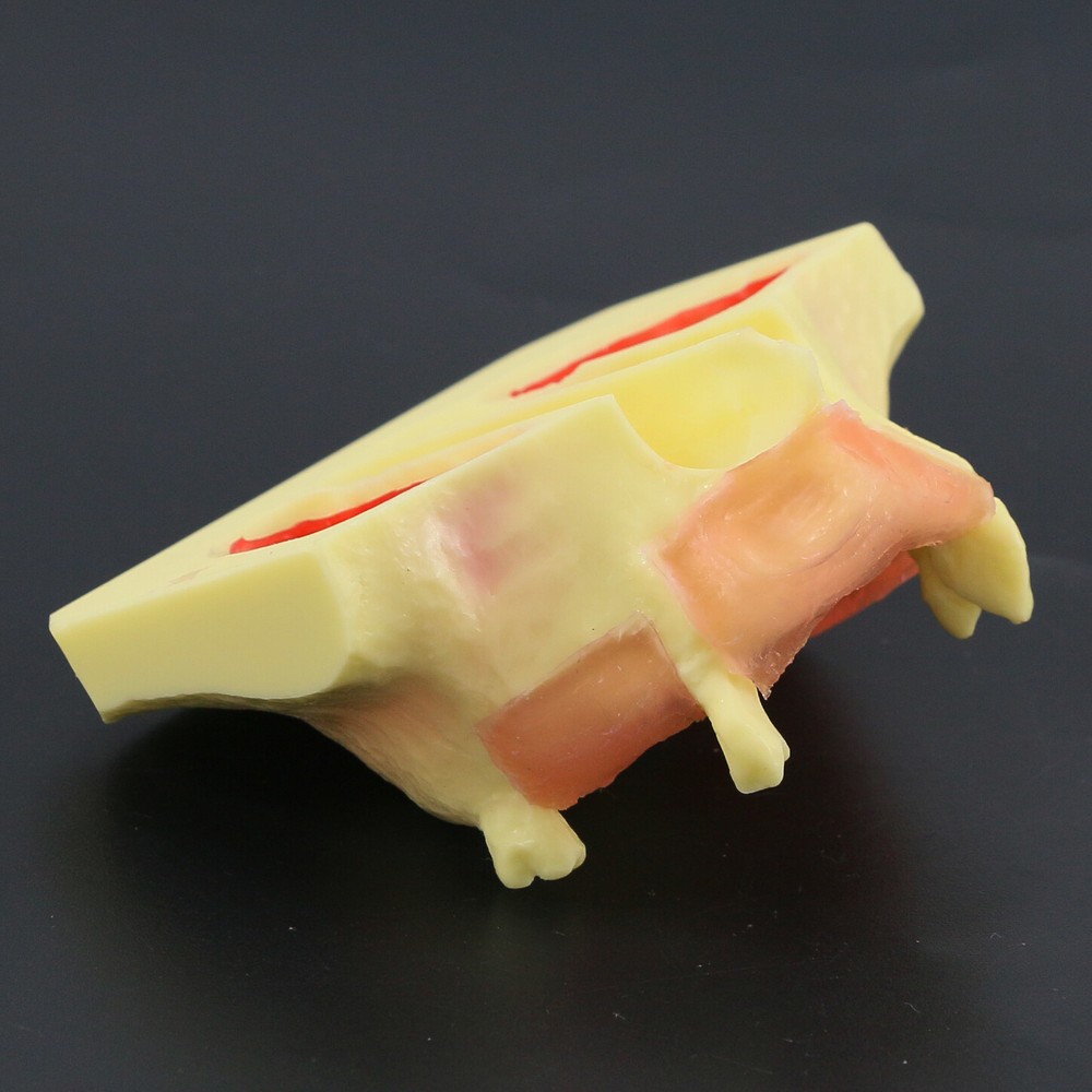 Dental Typodont Teeth Model Sinus Lift Practice Study Teach Demo Model 2012 2013