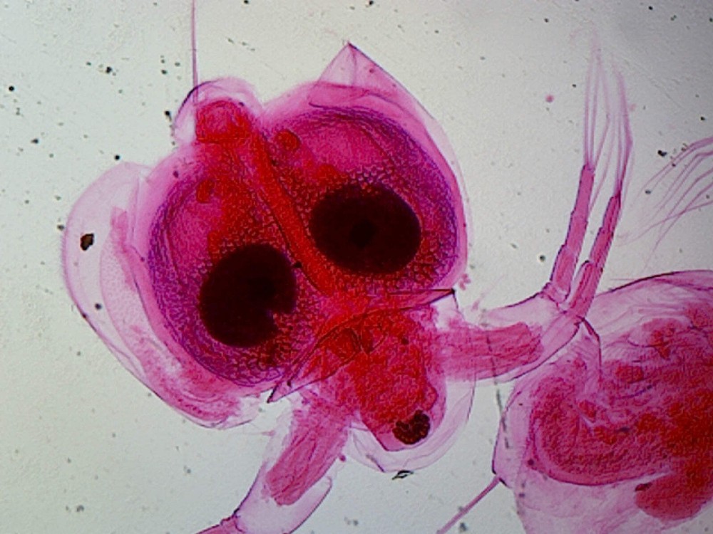 Cyclops (Arthropod, Crustacean); Whole-mount