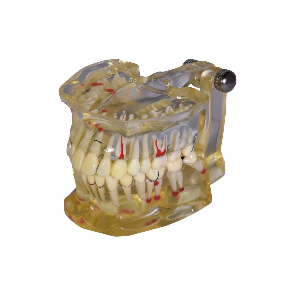 REDLAND Model Dental Demonstration Teeth Educational Model