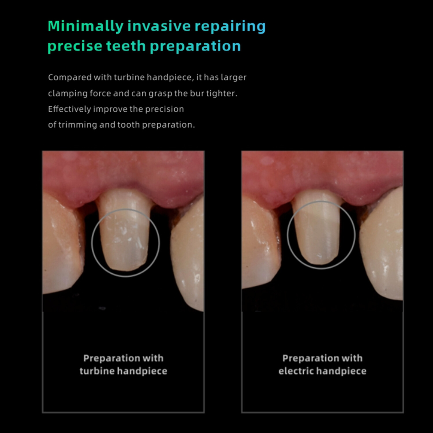 Original Woodpecker Dental Electric Motor MT2 MT3+1:5 Contra Angle LED Handpiece