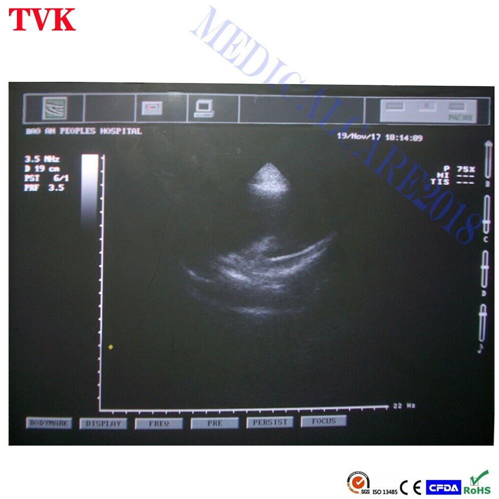 Mindray 3C5s Convex Array Ultrasound Probe Compatible M5 Abdominal Transducer