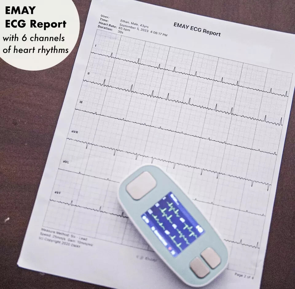 EMAY 6Leads Portable ECG Monitor Record ECG and Heart Rate in 6 Channels