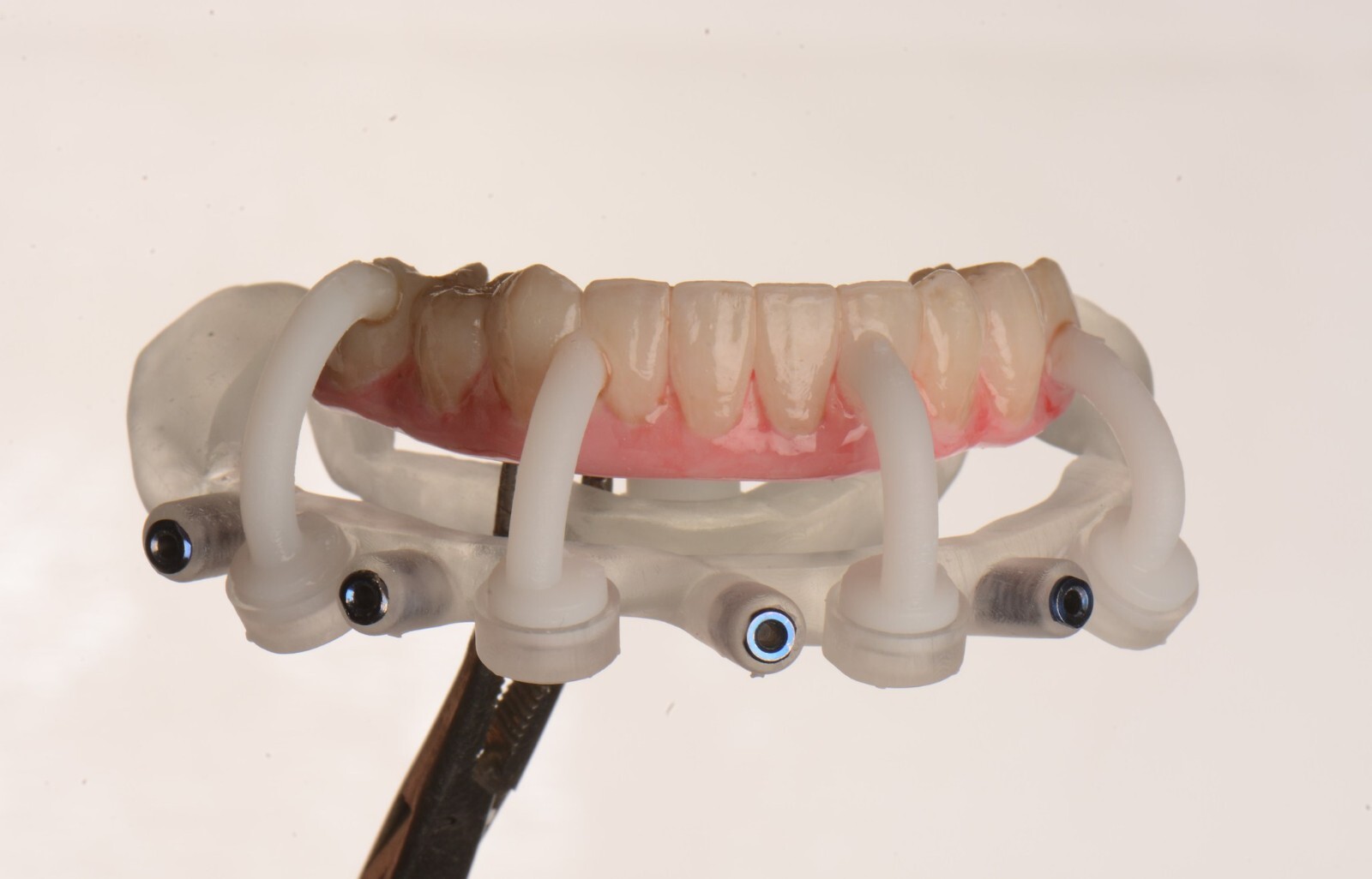 DLP SLA LCD 3d printer ALL ON X resin - for all on x cases, bridges,arcs, hybrid