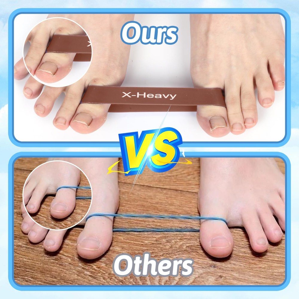 5Pcs Toe Bands Big Toe Spacers for Bunion Correction Portable Loop Resistance...