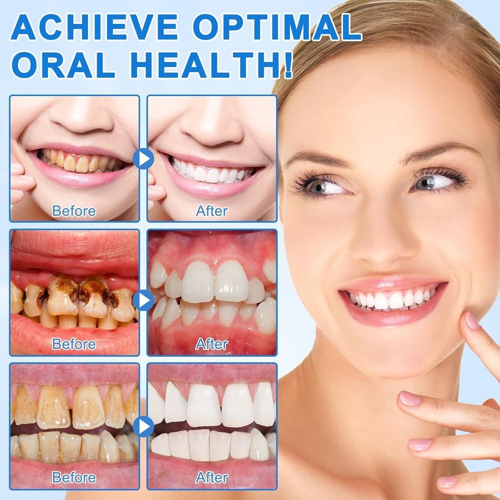 9.9% Hydroxyapatite Toothpaste, 4.23 Oz Nano Hydroxyapatite Toothpaste for Ename