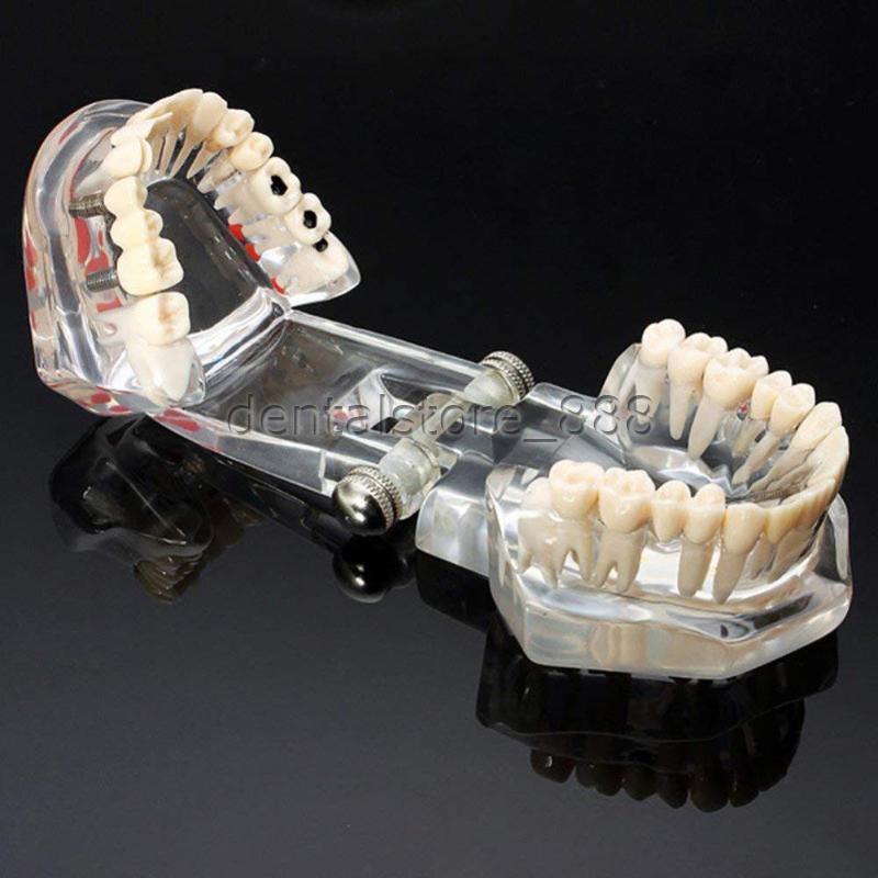 3D Human Teeth Gums Model Dentist Training Teaching Education