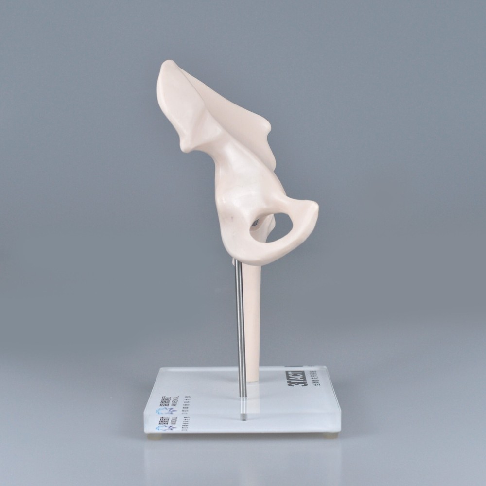 1/3 Artificial Hip Joint Replacement Anatomical Skeleton Demo Display Model