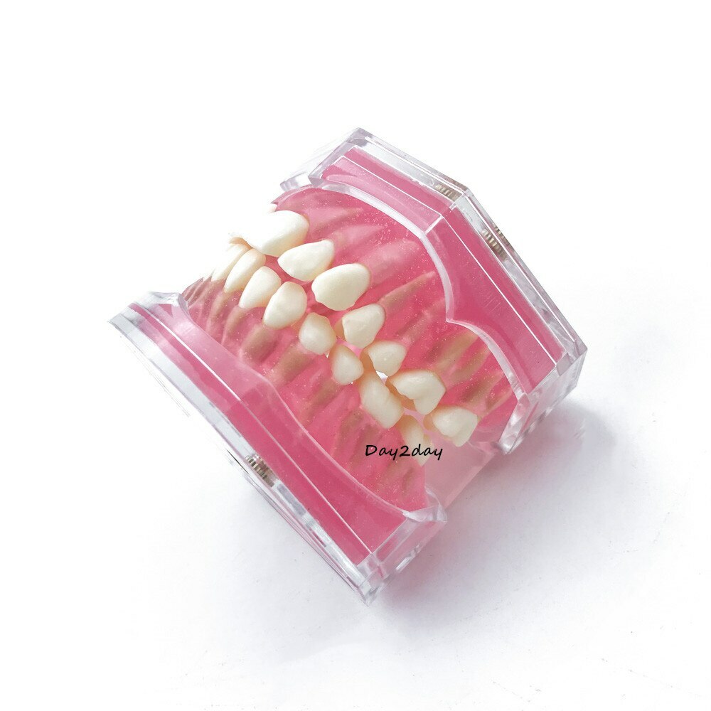 Teeth Model Dental Standard Model with Removable Teeth Dental Study Model
