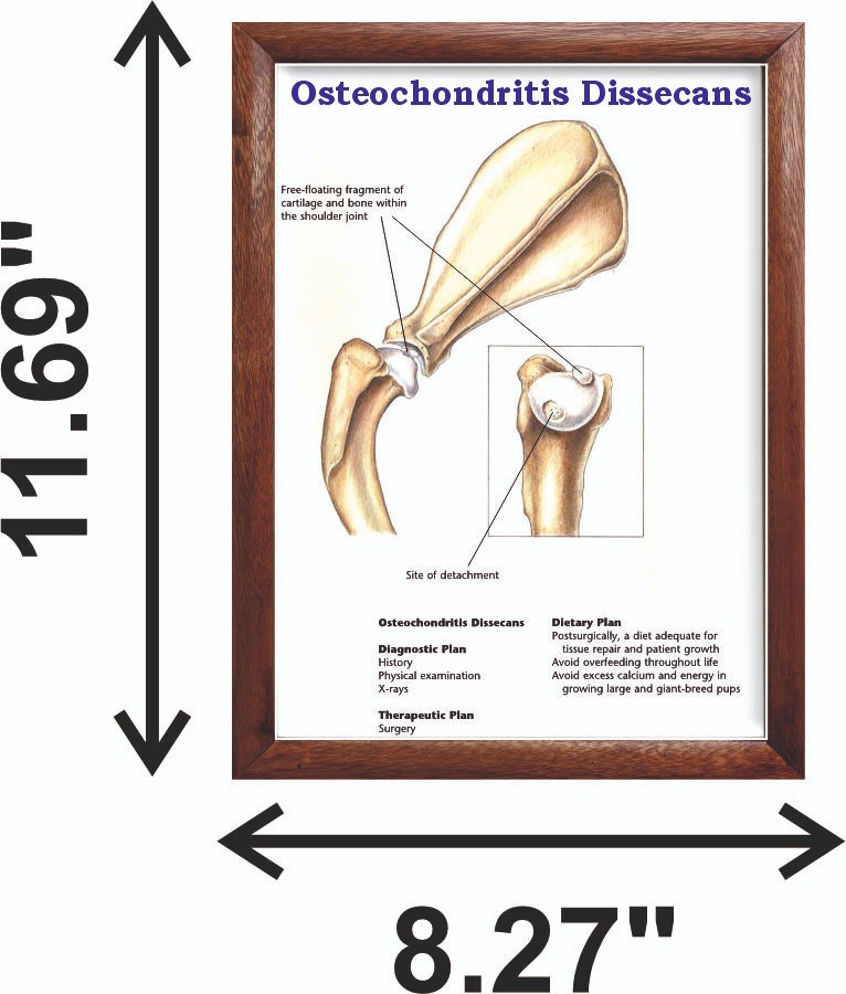 Osteochondritis Dissecans Chart 12x18 inches