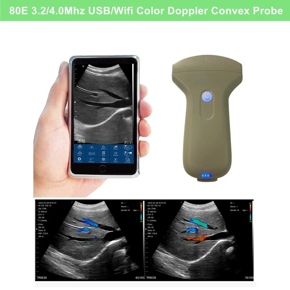 Portable 96E Wireless Ultrasound Scanner Machine w/ Convex Array Probe