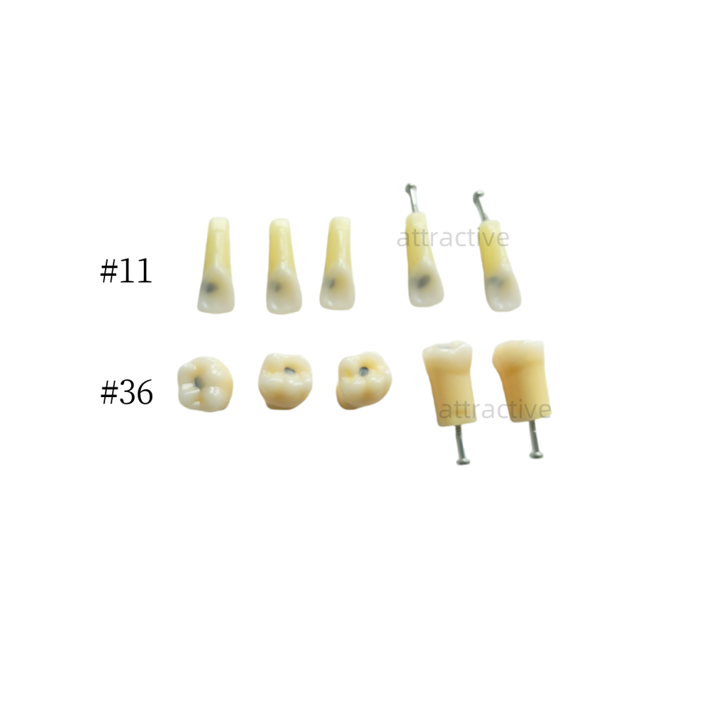Dental Molar/Front Vitro Teeth Decay Caries Tooth Model Dentist Student Practise