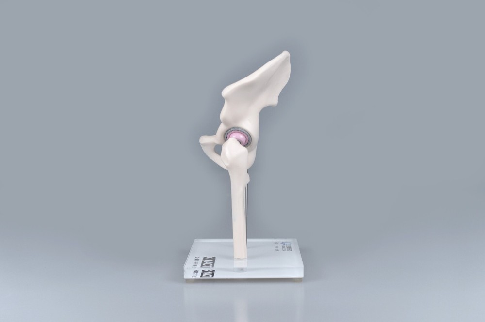 1/3 Artificial Hip Joint Replacement Anatomical Skeleton Demo Display Model