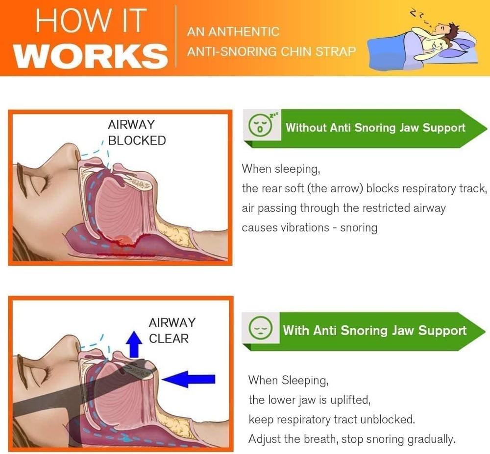 Anti Snoring Chin Strap for Sleeping, Snoring Solution, Effective Snore Stopper