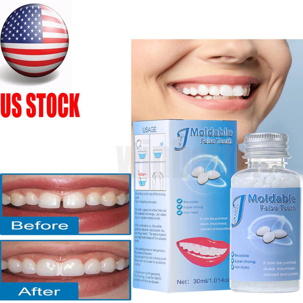 Moldable Teeth Beads Repair Kit - Temporary Fix for Missing, Broken or Gap Teeth