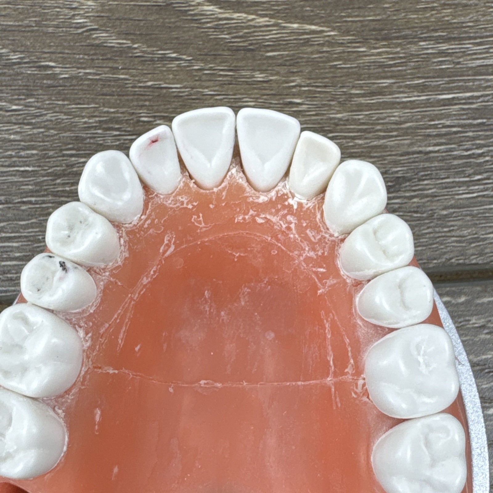 Acadental ModuPRO MP_R320 Restoration Typodont & Case WREB CDCA ADEX Teeth #58