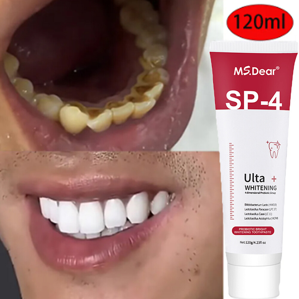Sip-4 Toothpaste, Whitening Sp-4 Toothpaste, Sp-4 Probiotic Whitening Toothpaste