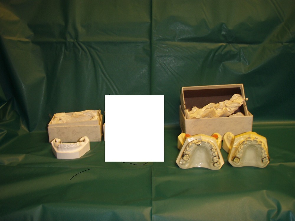 Plastic/Stone Orthodontic Models