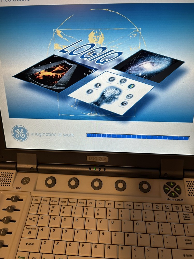 GE LOGIQ E Ultrasound System