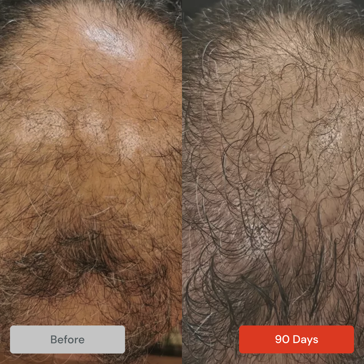 Men's Hair Loss Kit by DS Laboratories Including Revita S&C and Spectral DNC-N