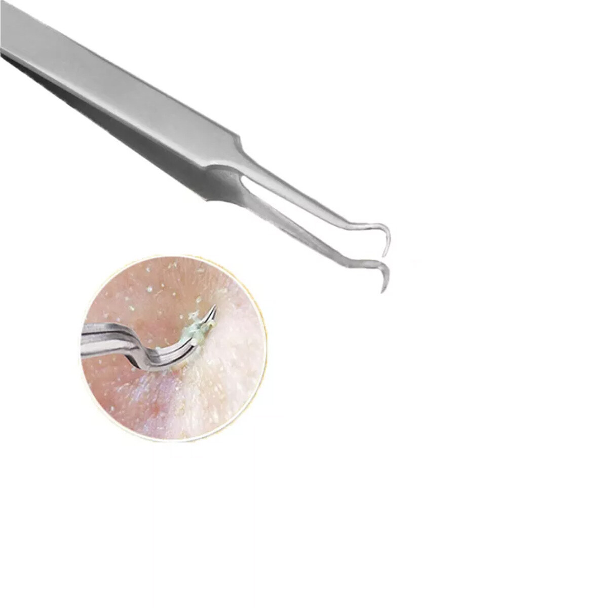 10 Pcs Pimple Popper Blackhead Remover Kit Tools Set Comedone Zit Extractor