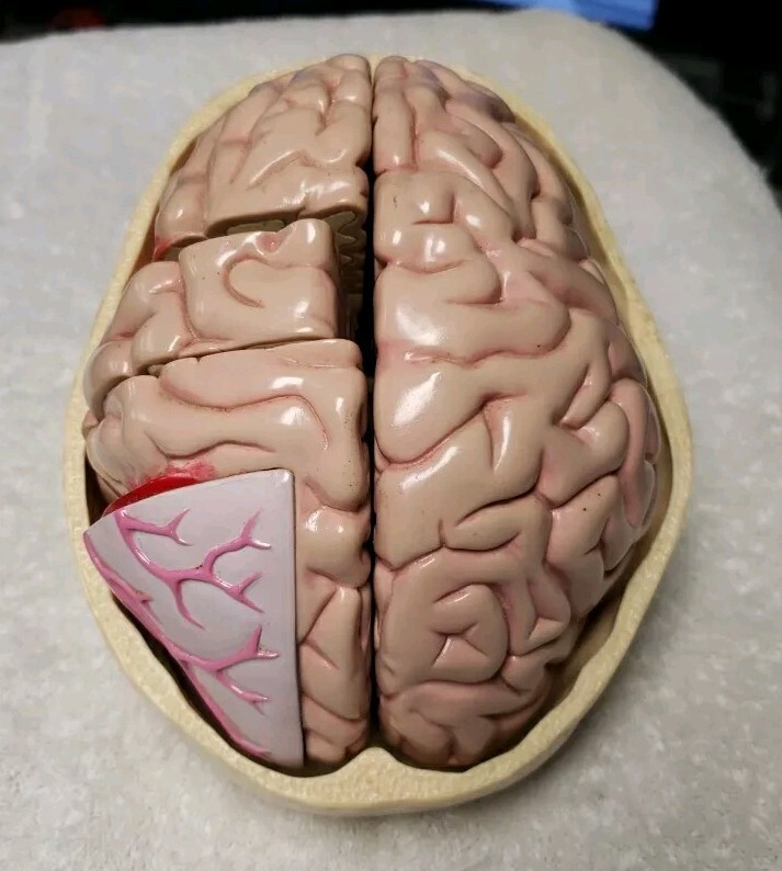 GPI Brain/ Partial Skull Model