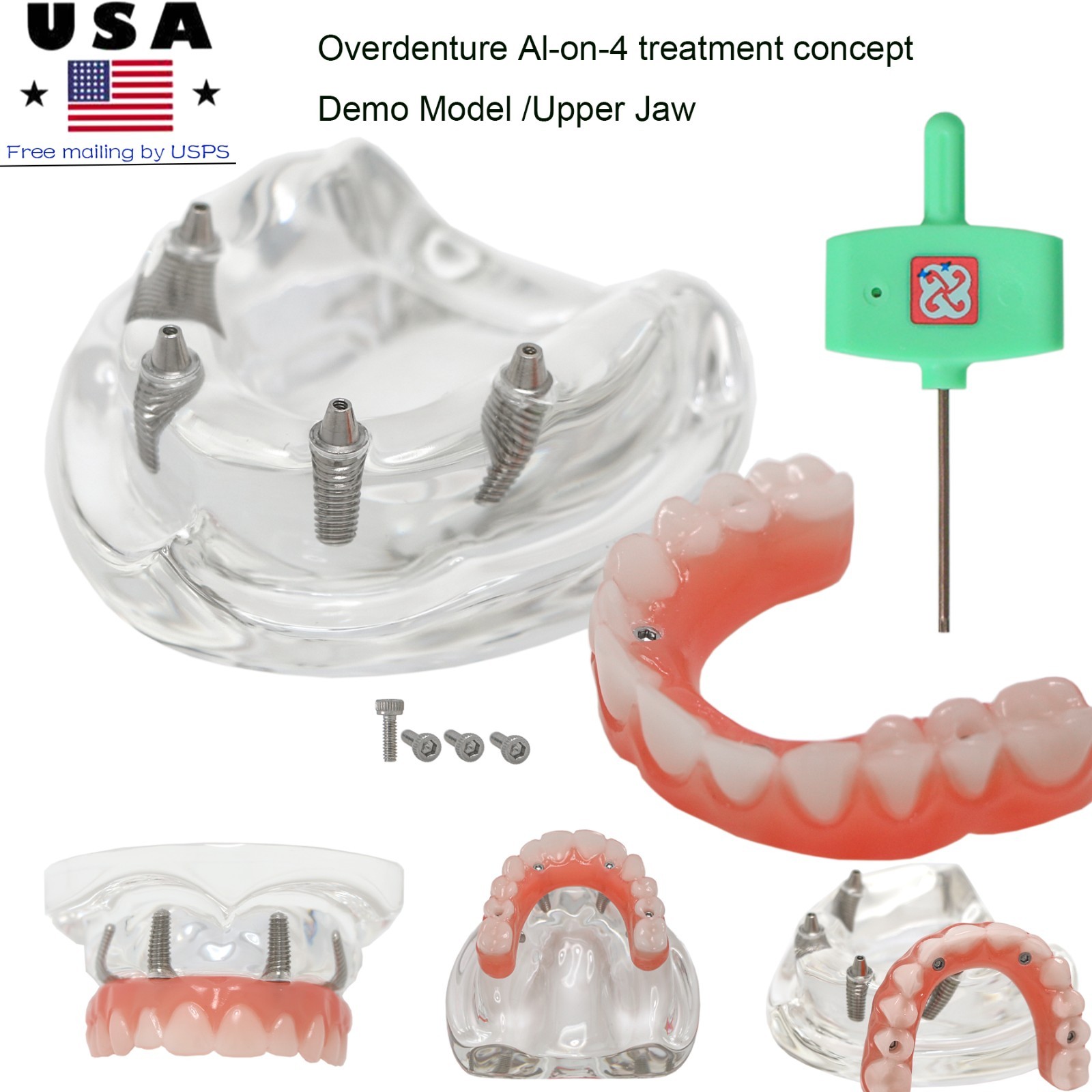 Implant Overdenture Al-on-4 treatment concept Demo Teeth Model Upper/4Srew Clear